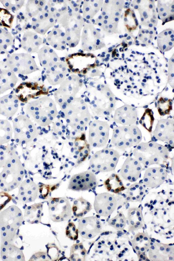 pa1742 1 IHC anti aquaporin 2 antibody
