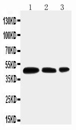 pa1742 2 WB anti aquaporin 2 antibody
