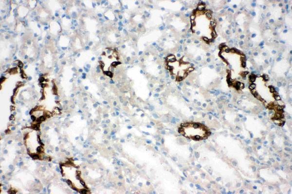 pa1742 3 IHC anti aquaporin 2 antibody