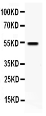 pa1756 1 WB anti vip receptor 1 antibody
