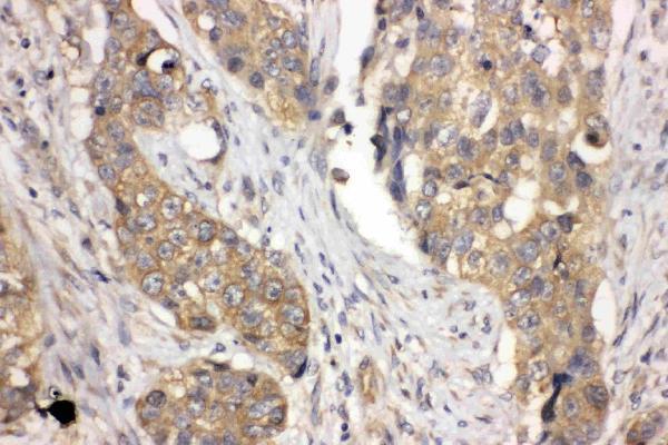pa1791 2 IHC anti lasp1 antibody