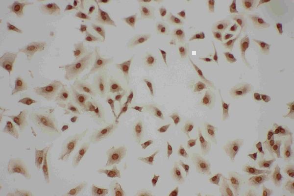 pa1791 3 IF anti lasp1 antibody