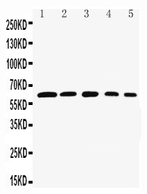 Anti-Rel B antibody, PA1803, Western blottingLane 1: Rat Testis Tissue LysateLane 2: HELA Cell LysateLane 3: NIH3T3 Cell LysateLane 4: RAJI Cell LysateLane 5: HEPA Cell Lysate