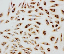 pa1804 4 IF anti paxillin antibody