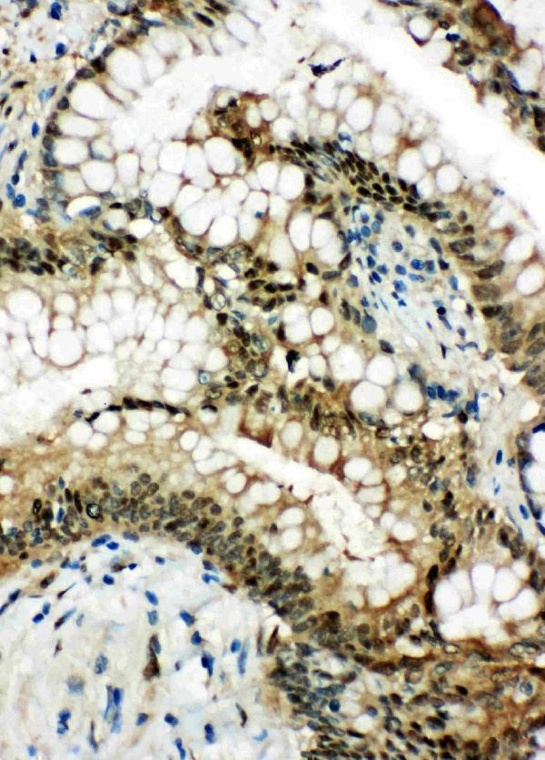 pa1813 2 IHC anti hsp70 antibody