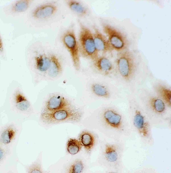 pa1813 3 IF anti hsp70 antibody