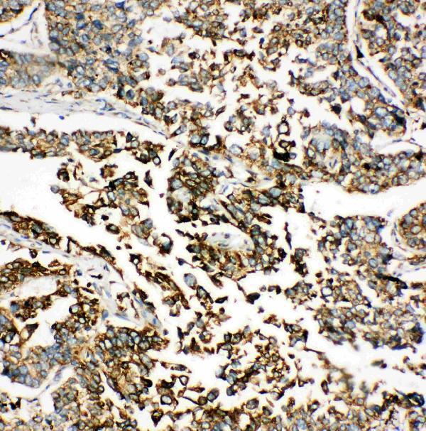 pa1815 4 IHC anti grp78 bip antibody
