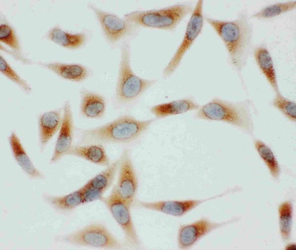 pa1815 5 IF anti grp78 bip antibody