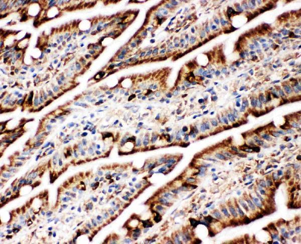 pa1815 6 IHC anti grp78 bip antibody