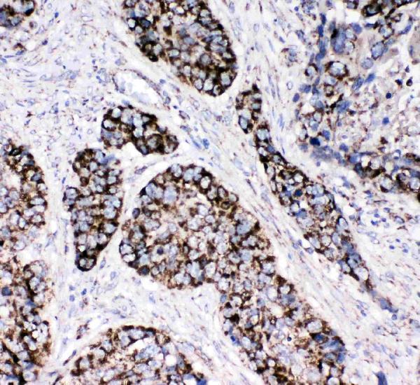pa1835 3 IHC anti peroxiredoxin 3 antibody