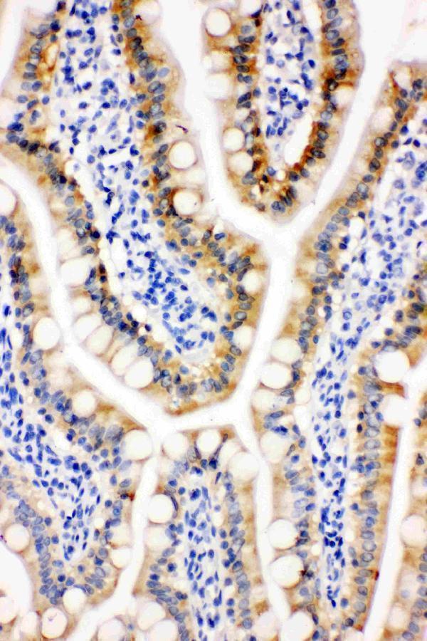 pa1836 2 IHC anti peroxiredoxin 3 antibody