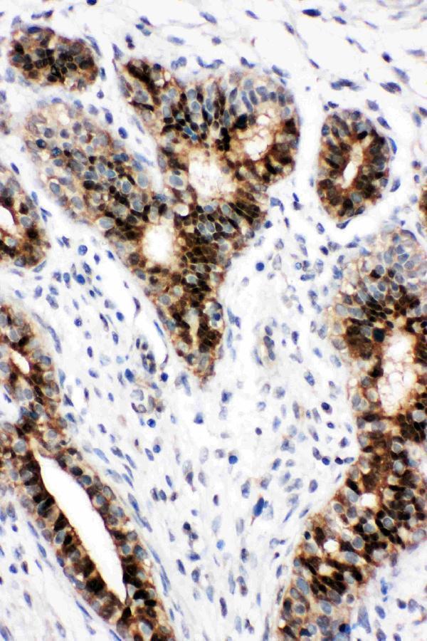 pa1841 2 IHC anti stat5b antibody