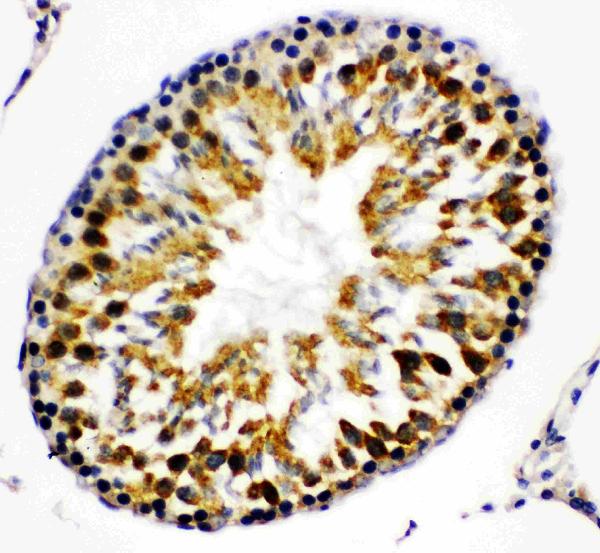 Anti-Beta Arrestin 2 antibody, PA1845, IHC(P) IHC(P): Rat Testis Tissue Anti-Beta Arrestin 2 antibody, PA1845, IHC(P) IHC(P): Rat Testis Tissue
