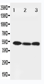 pa1847 1 WB anti beclin 1 antibody