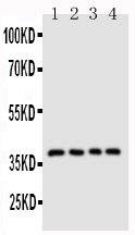 Anti-CD1d antibody, PA1850, Western blotting Lane 1: COLO320 Cell Lysate Lane 2: HELA Cell Lysate Lane 3: HT1080 Cell Lysate Lane 4: JURKAT Cell Lysate