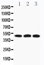 Anti-HYAL3 antibody, PA1856, Western blotting Lane 1: 22RV Cell Lysate Lane 2: HELA Cell Lysate Lane 3: V20S Cell Lysate