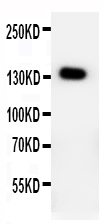 pa1859 1 WB anti ptch2 patched 2 antibody