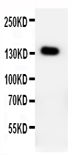 Anti-PTCH2 antibody, PA1859, Western blotting WB: HELA Cell Lysate
