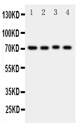 Anti-BCRP/ABCG2 antibody, PA1870, Western blotting All lanes: Anti BCRP/ABCG2 (PA1870) at 0.5ug/ml