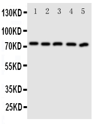Western blot validation image for ABCG5 using PA1871; observed band 72.5 kDa