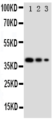 Anti-GATA2 antibody, PA1884, Western blotting Recombinant Protein Detection Source: E.coli derived -recombinant Human GATA2, 38.3KD