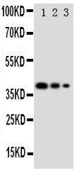 pa1884 1 WB anti gata2 antibody