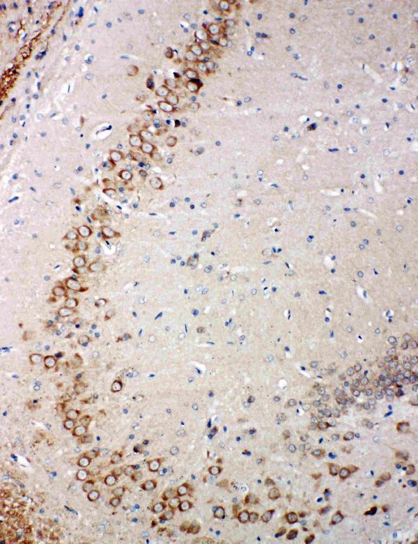 pa1885 2 IHC anti glutaredoxin 2 antibody