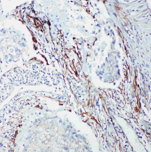 pa1897 4 IHC anti shc antibody