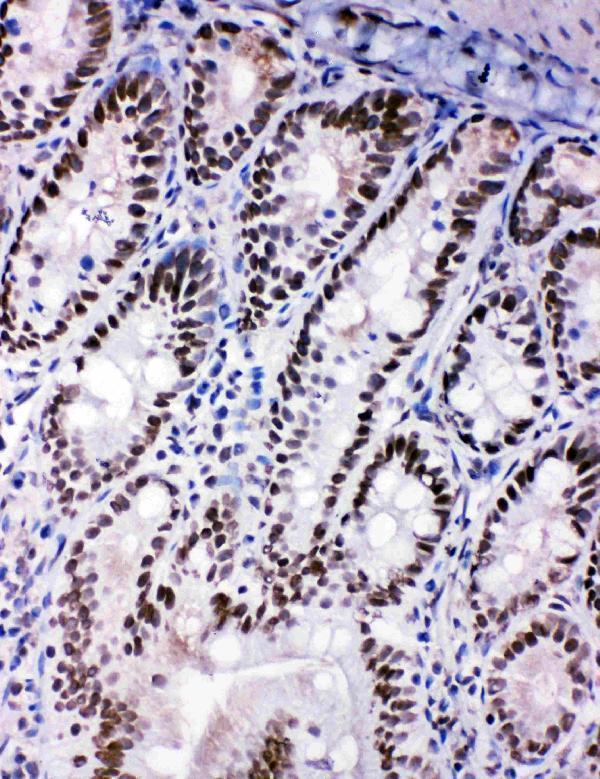 pa1897 5 IHC anti shc antibody