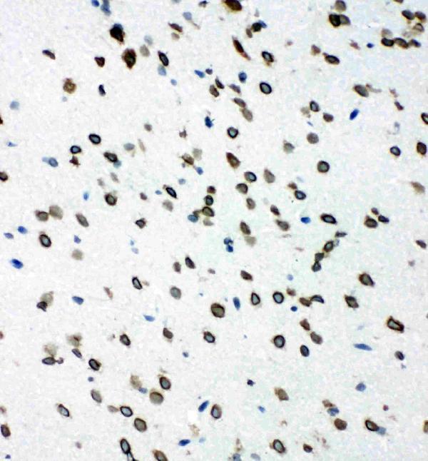pa1897 6 IHC anti shc antibody
