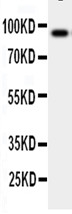 Anti-GCSF Receptor antibody, PA1906, Western blottingWB: Human Placenta Tissue Lysate
