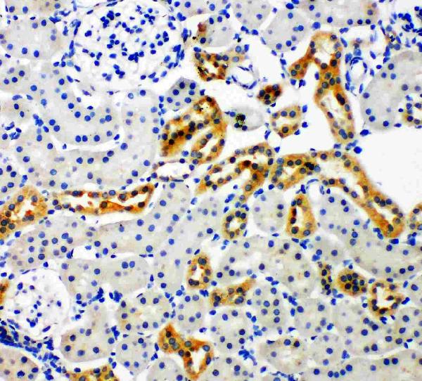 Figure 2. IHC analysis of NADPH OXIDASE 4/NOX4 using anti-NADPH OXIDASE 4/NOX4 antibody (PA1929). NADPH OXIDASE 4/NOX4 was detected in paraffin-embedded section of rat kidney tissues. Heat mediated antigen retrieval was performed in citrate buffer (pH6, epitope retrieval solution) for 20 mins. The tissue section was blocked with 10% goat serum. The tissue section was then incubated with 1microg/ml rabbit anti-NADPH OXIDASE 4/NOX4 Antibody (PA1929) overnight at 4°C. Biotinylated goat anti-rabbit IgG was used as secondary antibody and incubated for 30 minutes at 37°C. The tissue section was developed using Strepavidin-Biotin-Complex (SABC)(Catalog # SA1022) with DAB as the chromogen.