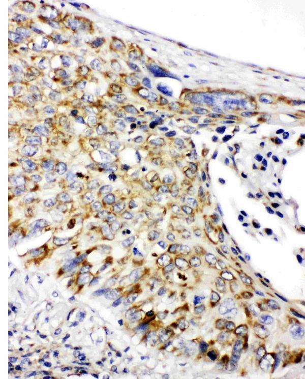 pa1932 2 IHC anti prohibitin antibody