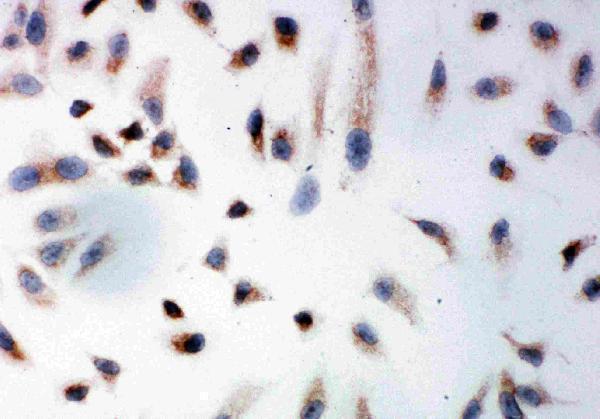 pa1932 3 IF anti prohibitin antibody