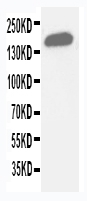 pa1941 1 WB anti gli2 antibody