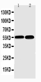 Anti-NFkB p100/p52 antibody, PA1946, Western blotting Lane 1: Mouse Liver Tissue Lysate Lane 2: HEPA Cell Lysate Anti-NFkB p100/p52 antibody, PA1946, Western blotting Lane 1: Mouse Liver Tissue Lysate Lane 2: HEPA Cell Lysate