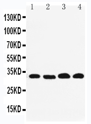 pa1951 1 WB anti rea antibody