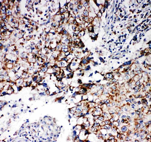 pa1951 2 IHC anti rea antibody