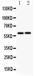 Anti-LTBR antibody, PA1968,  Western blottingAll lanes: Anti LTBR (PA1968) at 0