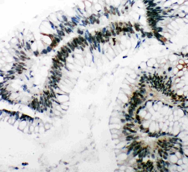 pa1976 2 IHC anti 53bp1 antibody