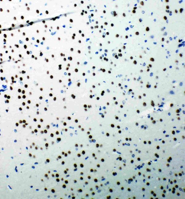 pa1976 3 IHC anti 53bp1 antibody
