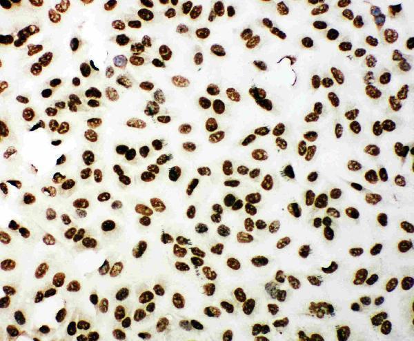 pa1976 5 IF anti 53bp1 antibody