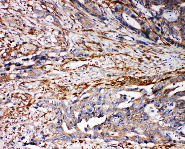 pa1977 1 IHC anti vrl1 antibody