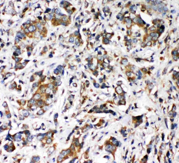 pa1977 2 IHC anti vrl1 antibody