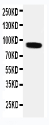 pa1977 3 WB anti vrl1 antibody