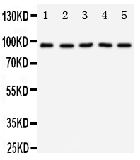 Anti-TrkC antibody, PA1992-1, Western blottingLane 1: Rat Brain Tissue LysateLane 2: Mouse Brain Tissue LysateLane 3: U87 Cell LysateLane 4: SHG Cell LysateLane 5: NEURO Cell Lysate
