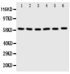 pa1995 1 WB anti scly selenocysteine lyase antibody