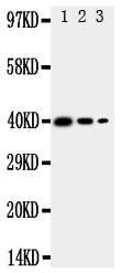 Anti-TRAM2 antibody, PA2011, Western blotting Recombinant Protein Detection Source: E.coli derived -recombinant Mouse TRAM2,39.0KD (162aa tag+R190-P370) Lane 1: Recombinant Mouse TRAM2 Protein 10ng Lane 2: Recombinant Mouse TRAM2 Protein 5ng Lane 3: Recombinant Mouse TRAM2 Protein 2.5ng