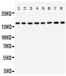 pa2012 1 WB anti hamartin antibody