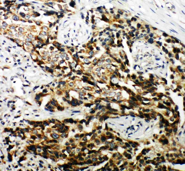 pa2012 2 IHC anti hamartin antibody